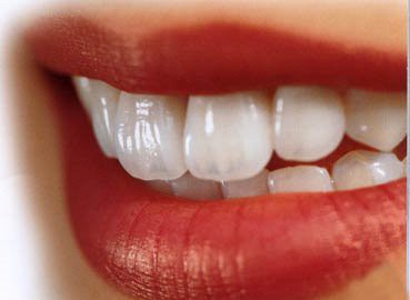 estetica_dentara