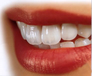 estetica_dentara